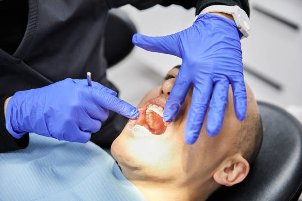 Best Emergency Dental Care for Broken or Chipped Teeth in West Modesto, CA